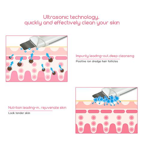 Ultrasonic Skin Scrubber Facial Spa Vibration Massager