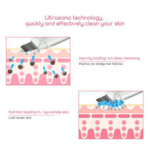 Ultrasonic Skin Scrubber Facial Spa Vibration Massager