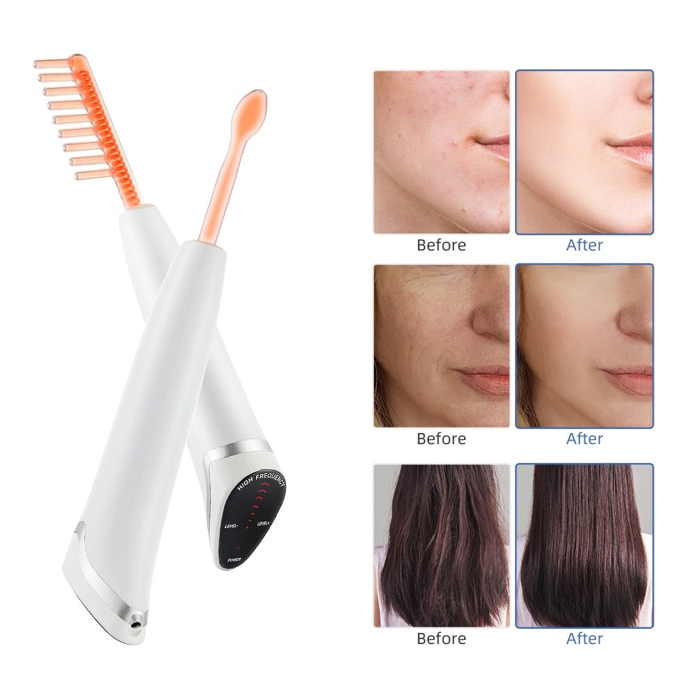 New 6 in 1 High Frequency Electrode Wand Electrotherapy Glass Tube Anti Wrinkle